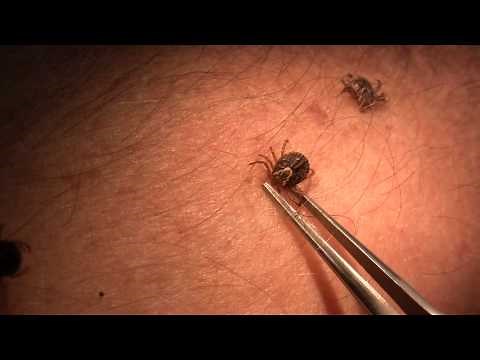 Tick attachment and removal (video by B. Drees and P. Teel)