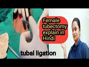 लीजिए female tubactomy set की पूरी जानकारी