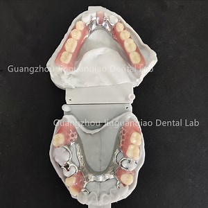 [Hot Item] 3D Print Durable Cast Metal Framework with Acrylic Dentures Fit Perfectly Natural and Beautiful Looking