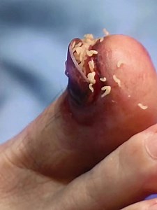 ER Doctor Encounters Maggots, Fireflies & More!