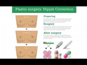 Inverted Nipple Correction Surgery (Nipple Inversion) ; Definition, Procedure, Purpose, Uses