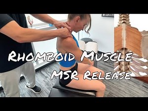 Rhomboid Muscle Release - MSR Procedures