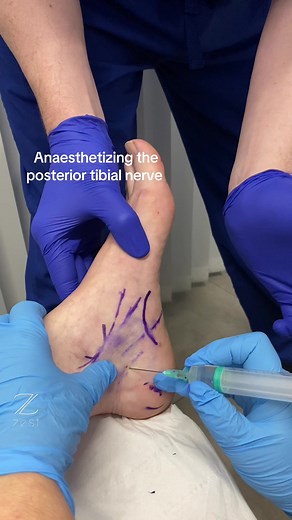 Ankle Block Techniques with Dr. Ian Reilly
