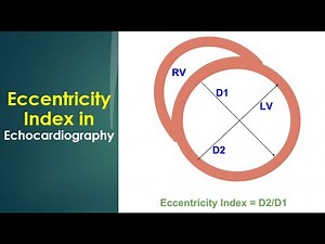 Eccentricity Index in Echocardiography