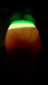 You are looking at an illuminated, critically endangered California condor egg. See that dark blob moving around? That is a chick! 🐣 A California condor embryo takes 57 days (about 2 months) to fully mature. Animal care staff monitor the growth and position of chicks inside eggs by a process called candling, where a light is held up to the side of an egg to illuminate the inside while in a dark room. The chick is dark, the blood vessels grow over time, and the bright point at the top of the egg