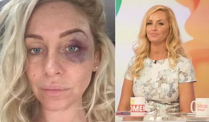'I thought I was going to die' Josie Gibson describes horrific taxi attack - Extra.ie