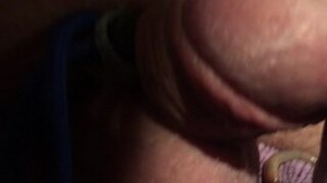 SML worms in cock urethra