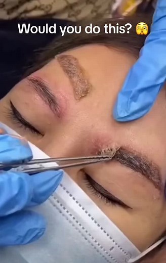 Satisfying Scab Removal and Eyebrow Flakes ASMR