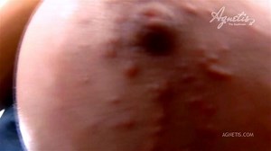 Agnetis Miracle closer