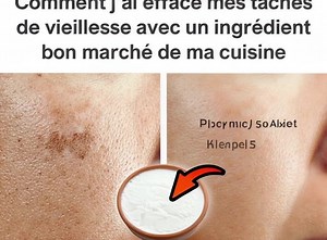 Comment j'ai effacé mes taches de vieillesse avec un ingrédient bon marché de ma cuisine (lien en commentaire) | TousPerfect
