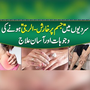 27K views · 253 reactions | Sardiyon Mein Kharish Ka ilaj - Winter Dry Skin & Itching Treatment - How to Stop Winter Itching? - Winter Pruritus Treatment #WinterItching #DrySkin #SkinCare #WinterSkinCare #WinterTreatment #SkinItching #WinterDryness #Dermatology #SkinHealth #HomeRemedies | Sehat Mand - Health & Lifestyle | Facebook