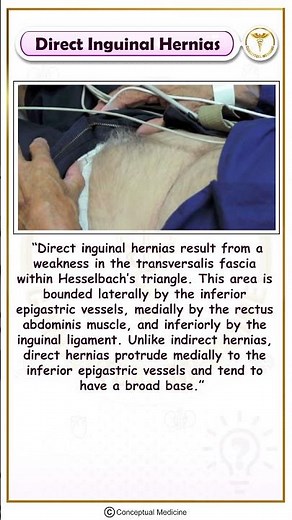 Direct Inguinal Hernia : Patient Presentation