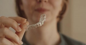 Close-up Woman Holding Transparent Dental Aligner Stock Footage Video (100% Royalty-free) 3977338031 | Shutterstock