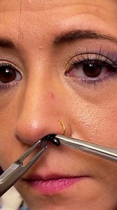 3M views · 2.7K reactions | He removed an insect from her nose! This original video was produced by Network Media, LLC and Manuella. | Possibly Genius | Facebook