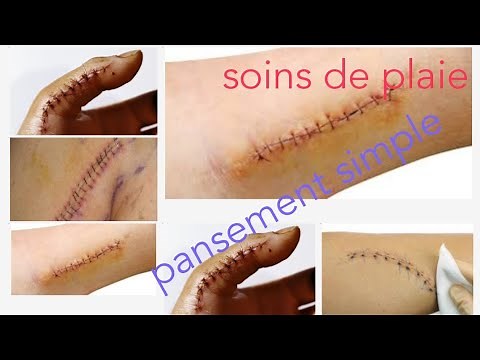 Soins infirmiers en chirurgie: soins des plaies : pansement simple