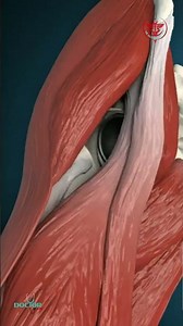 Total Femur Head Replacement