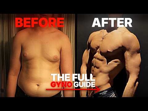 How I built an AESTHETIC CHEST even with GYNO (FULL GUIDE)