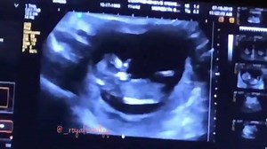 13K views · 247 reactions | Queen is really pregnant !! | Harding Dominique | Facebook