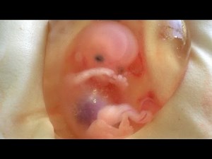 Heart forms earlier than we thought it did
