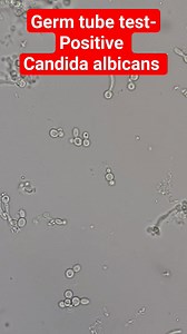 18K views · 321 reactions | Germ Tube Test #lablife #microbiology | Lab life | Facebook