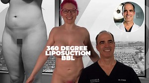 The Surprising Aftermath of This Popular Adult Entertainer's Liposuction Surgery! - YTboob