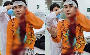 Nam diễn viên Ngô Sỹ Lâm phim 'Thương ngày nắng về' bị chém trọng thương sau va chạm giao thông