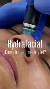 3.9K views · 20 reactions | El Hydrafacial es un facial único que...