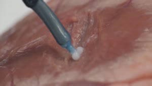 Introducing What Could Be The Future of Surgery! A 3D Printing Robot