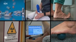 👉 www.ndr.de/fersensporn124.html Wer wie Sylvia S. an Fersensporn leidet, weiß: Die Schmerzen können schlimm sein. Auf welche Auslöser sollte man achten und wie lassen sich die Beschwerden effektiv behandeln? | ARD GESUND