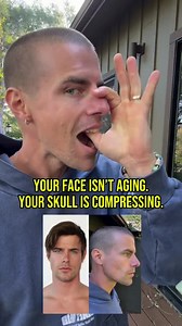 Comment “cranial” and I’ll send you my Cranial Sacral & Nervous System Reset course. Most people try to change their face through the skin or muscles. But the real shift happens deeper. Over time the bones of the skull slowly compress from stress, jaw tension, mouth breathing, and nervous system overload. When that happens the mid-face tightens, the jaw locks, the eyes look more tired, and the whole face loses space. This simple cranial release helps reverse that compression. How to do it: Place