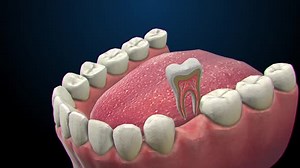 3D Dental Animation of Tooth Extraction and Internal Structure