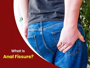 Anal Fissure: Symptoms, Causes And Treatment
