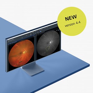 FORUM ophthalmology software