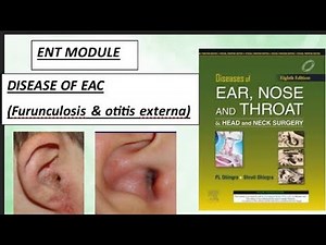 ENT- EXTERNAL EAR - Diseases of external auditory canal (MALIGNANT/NECROTIZING OTITIS EXTERNA ) #ent