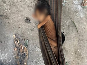Missionário em Roraima fala sobre foto da criança yanomami desnutrida
