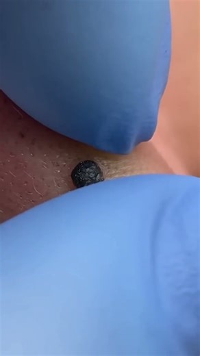 Big Ear Pop