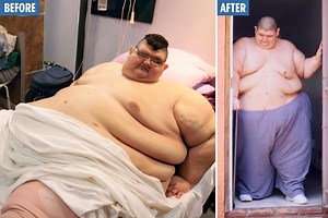 World's fattest man who weighed 93st back on his feet after shedding 52st