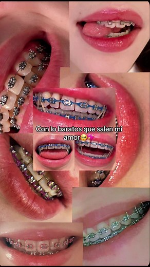 🫦😍 #brackets #parati #lindasonrisaconbraketsbrillantes💘 #sigueme #itzeldiaz💐 🌸🫦