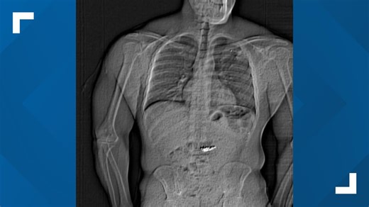 Florida man swallows $769K jewelry stolen from Orlando mall, police say