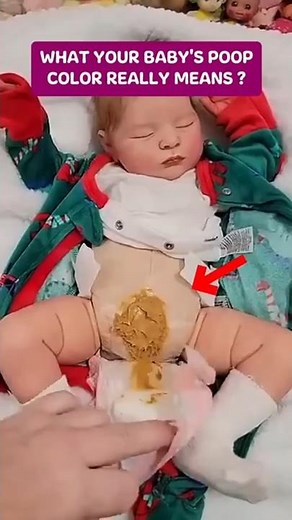 What does your baby's poop colour really mean?🤔