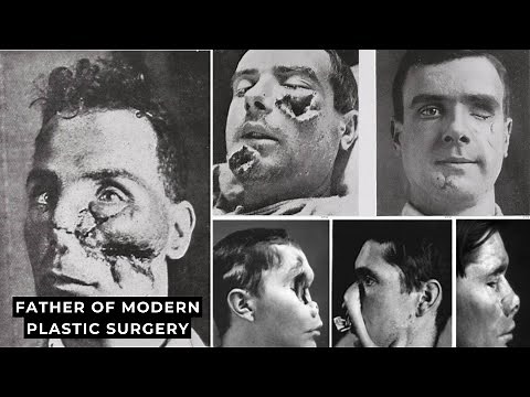 World War I Soldiers returned with brutal facial injuries