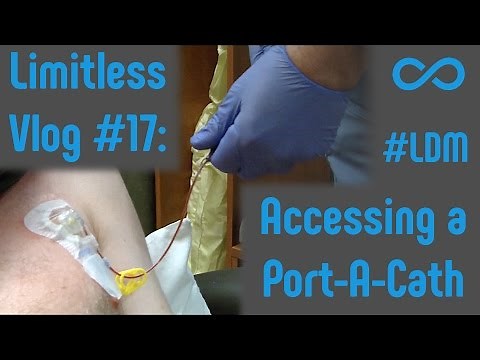 Port-A-Cath Insertion/Removal | Limitless Vlog