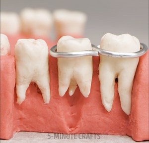 7.4M views · 10K reactions | Proyek Plastilin untuk penjelasan proses medis yang lucu! | Kerajinan 5-Menit Gadis | Facebook