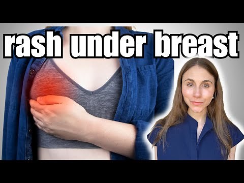 Rash Under Breast Causes & Treatments Explained