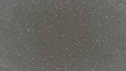 Healthy human sperm under microscope