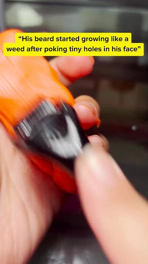 6.7K views | Does your beard need help? Save 35% off with code EARLYBIRD35 倫‍♂️‼️ | Beard Club | Facebook