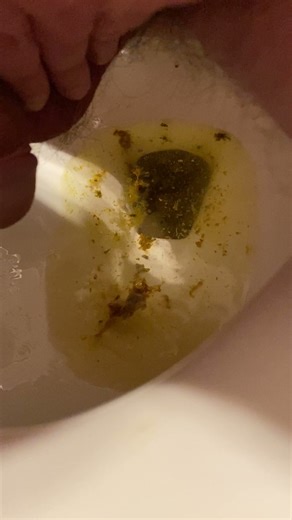 Loose Evening Shit, Huge Fart