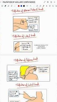 EXAMINATION OF AXILLARY LYMPH NODES OVERVIEW