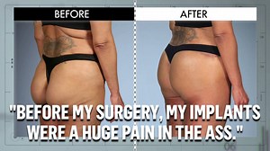 34K views · 27 shares | Last night on Botched, the docs saved a nose...