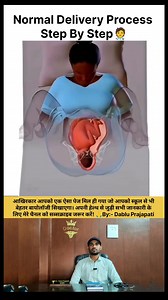 17K views · 766 reactions | Normal Delivery Process Step by step 六‍⚕️ #normaldelivery #pregnancy #cyseriandelivery #wellness #childdevelopment | Dablu Prajapati | Facebook